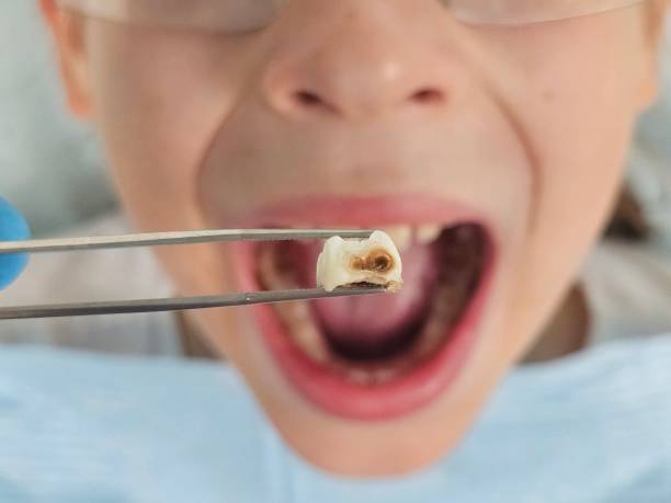 Best Emergency Cosmetic Dentistry in Venersborg, WA